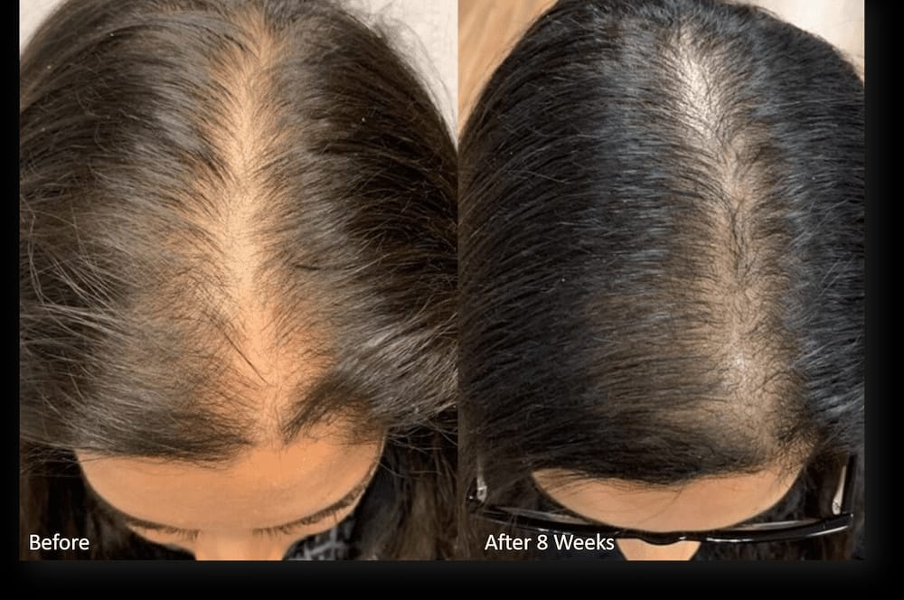 Oregrow Premium Herbal Shampoo – Hair Fall Control Formula✨🍀