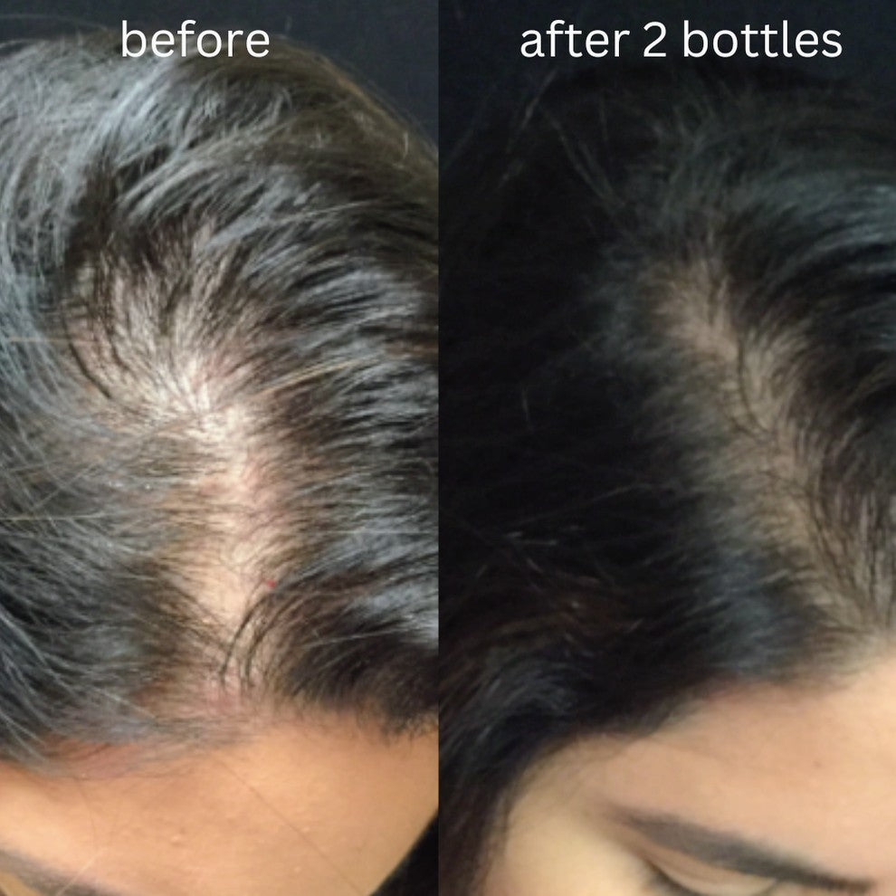 Oregrow Premium Herbal Shampoo – Hair Fall Control Formula✨🍀
